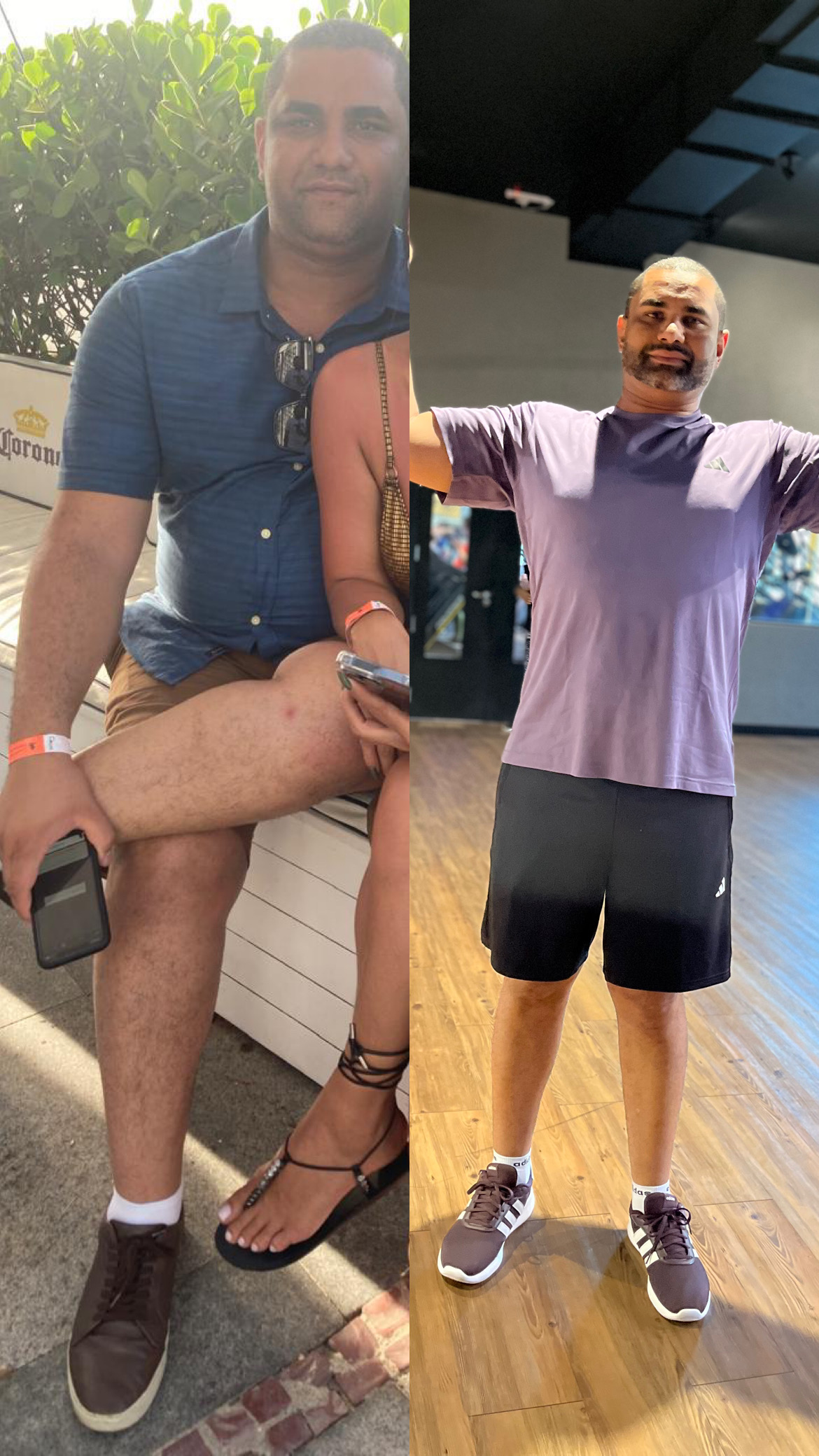 Resultado de Daniel - antes e depois