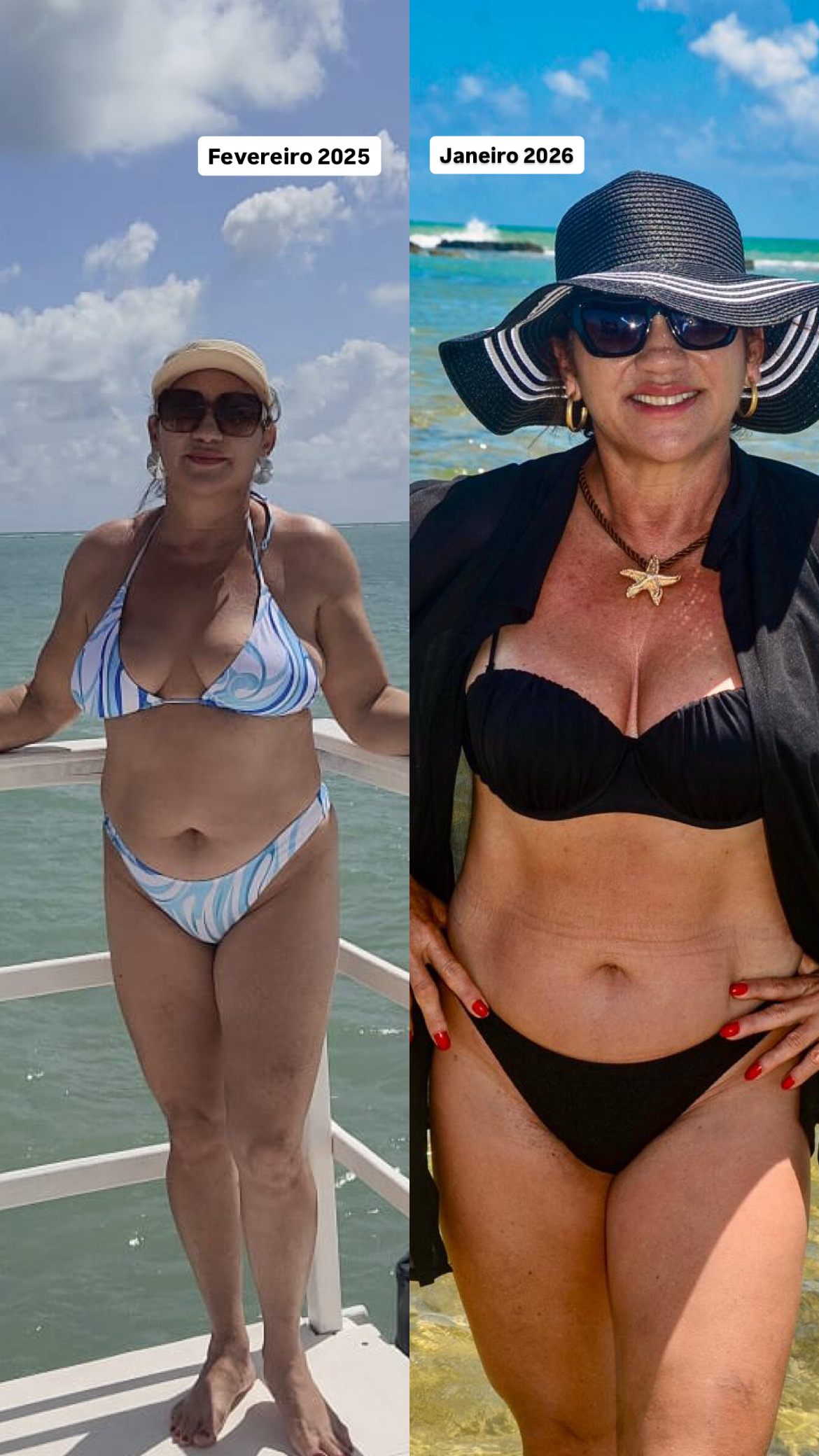Resultado de Mari - antes e depois
