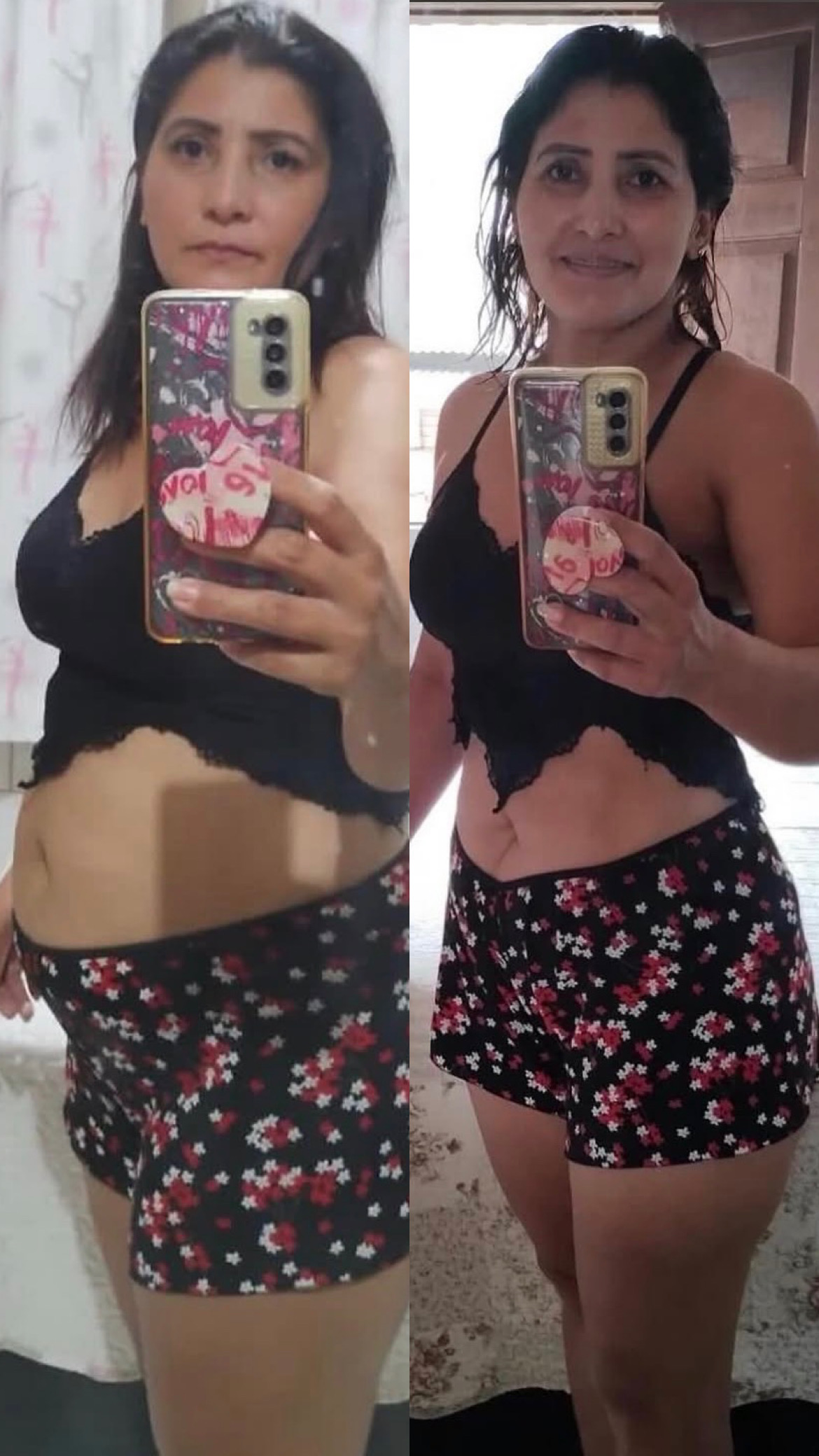 Resultado de Edilene - antes e depois