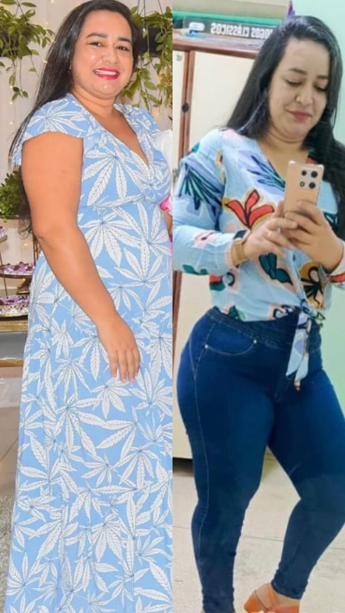 Resultado de Fernanda - antes e depois